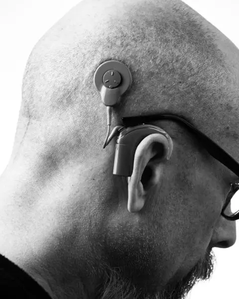Dealing with Hearing Loss Solutions and Support Systems